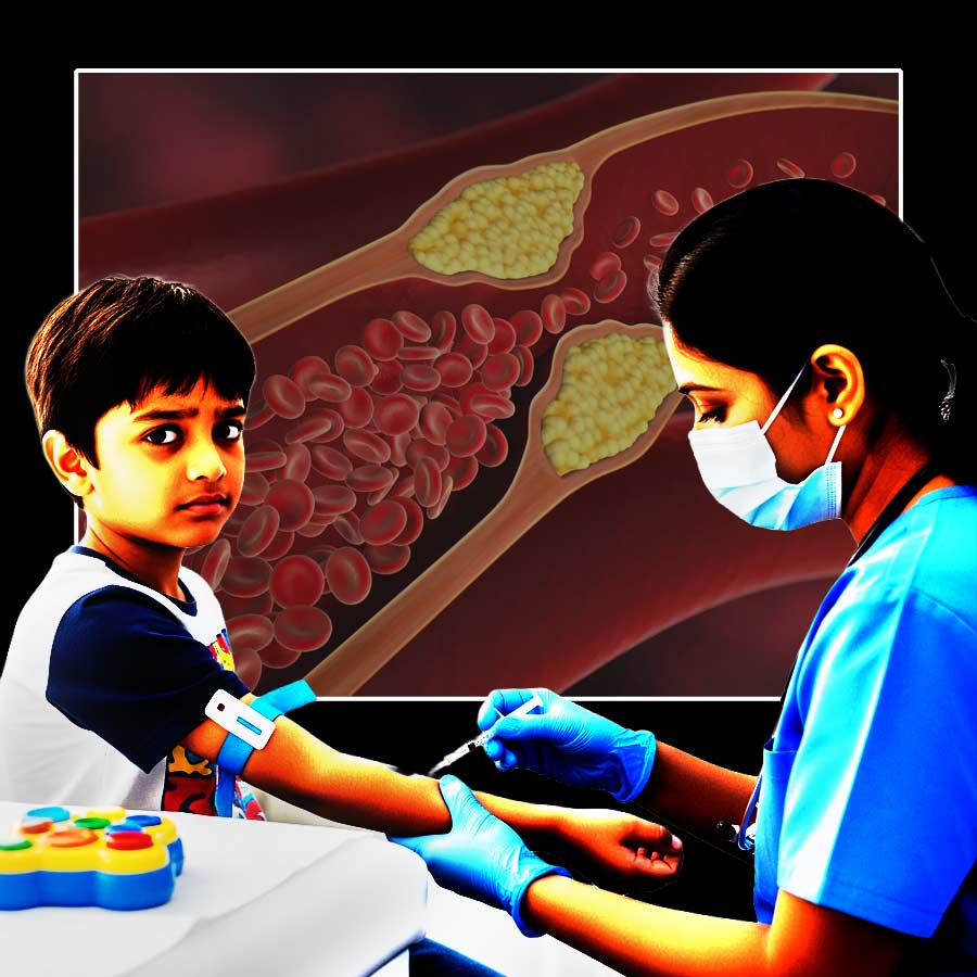 According to New guideline Cholesterol screening is recommended for all children between the ages of 9-11