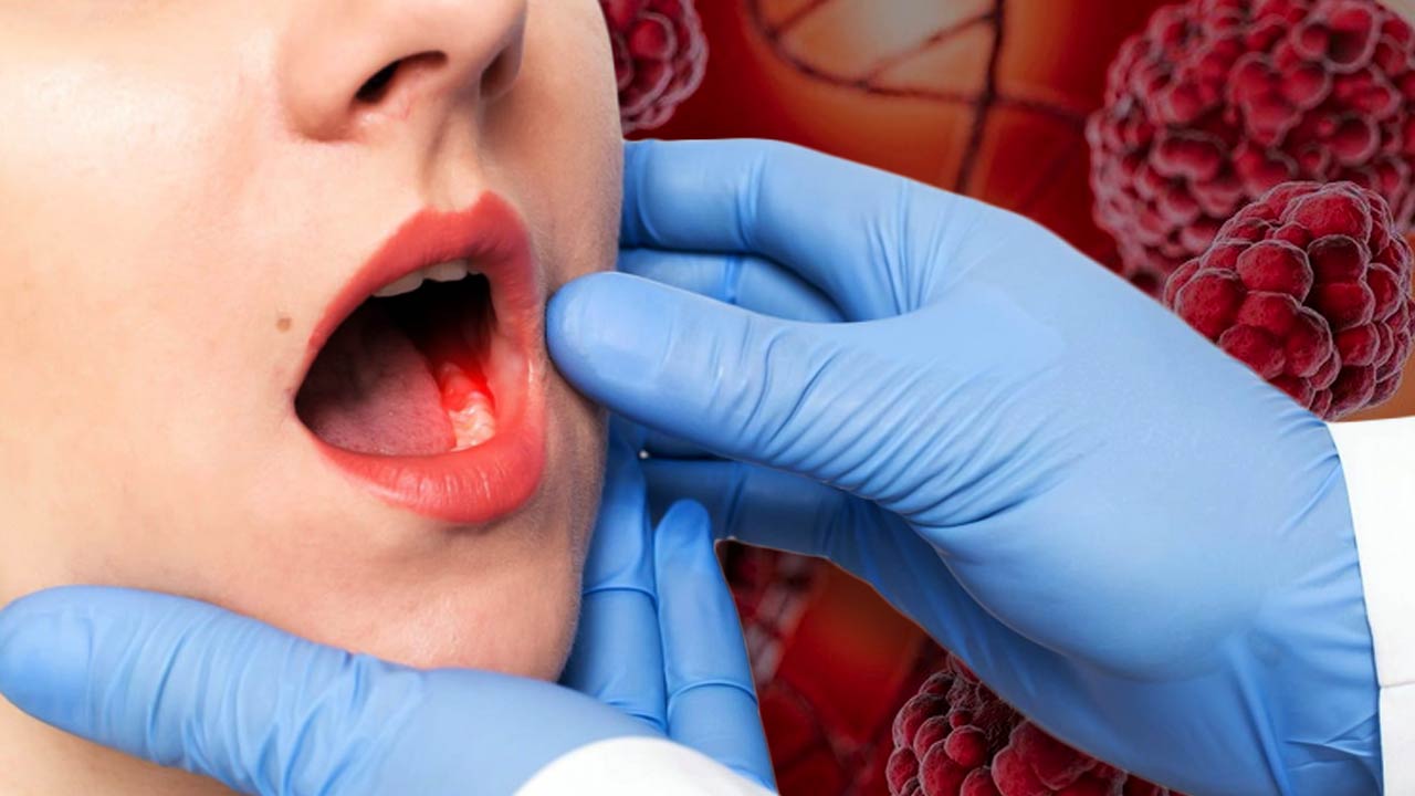 মুখগহ্বরের ক্যানসারের ঝুঁকি।