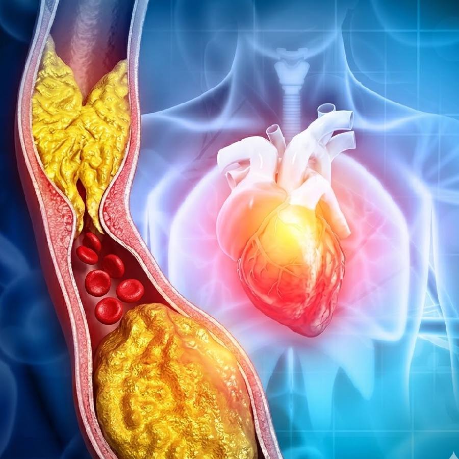 Five tips you should follow to lower your cholesterol level naturally dgtl