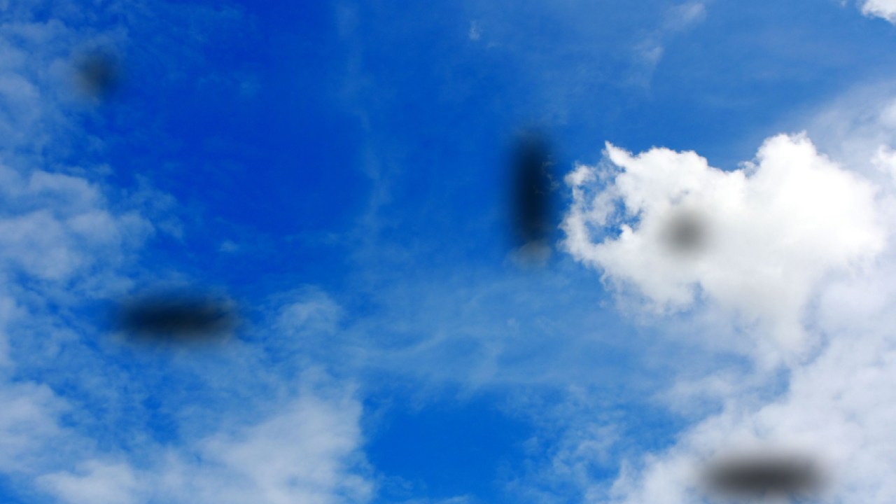 হঠাৎ ছোট ছোট দাগ, সুতো বা জালের মতো ছায়া ভেসে ওঠে চোখে?