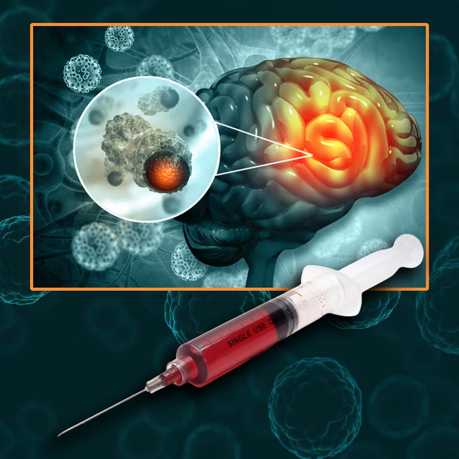 Scientists have found Virus therapy can cure most aggressive form of Brain Cancer