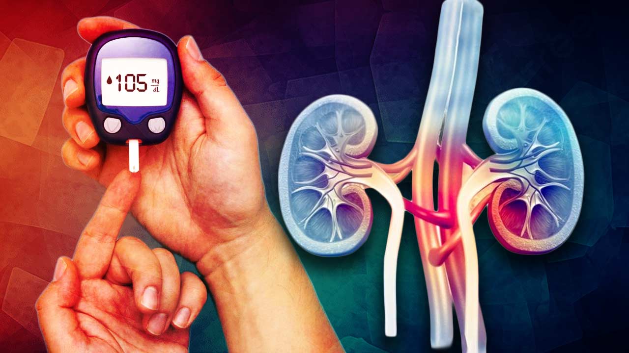 5 Essential Dietary Changes to Prevent Diabetic Kidney Disease