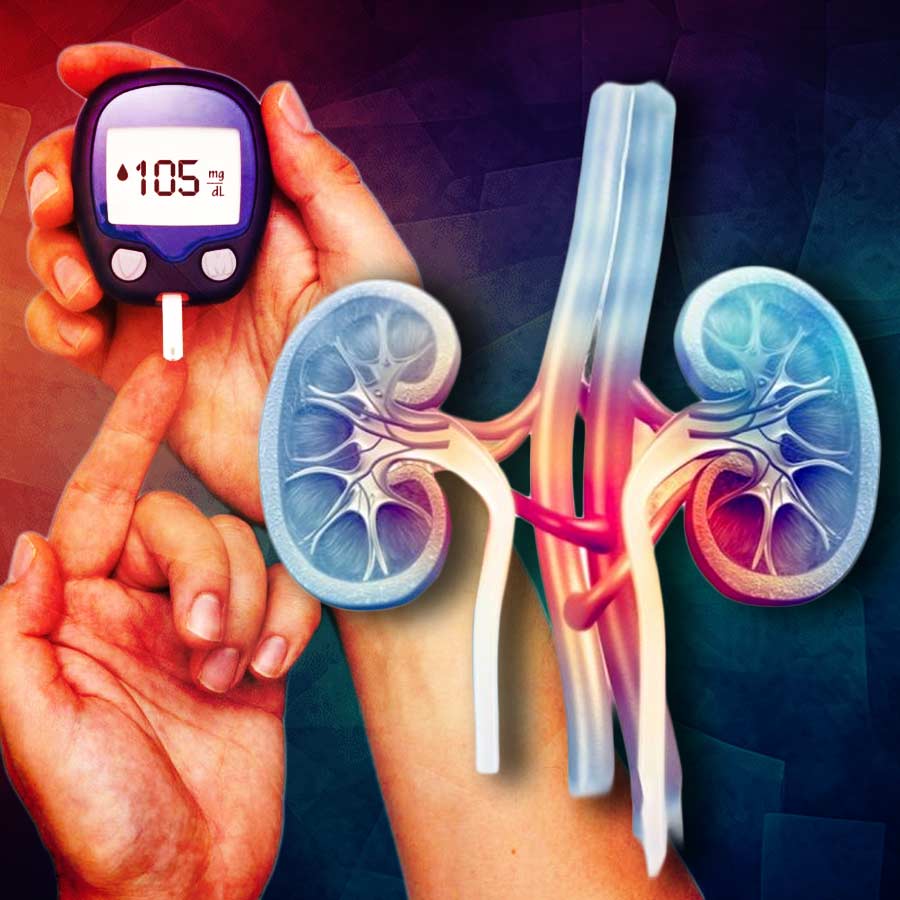 5 Essential Dietary Changes to Prevent Diabetic Kidney Disease