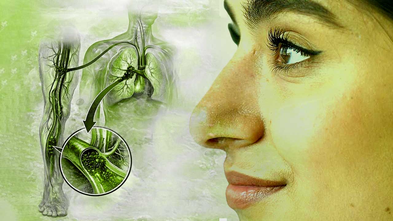 What is pulmonary embolism, what are the symptoms of this disease