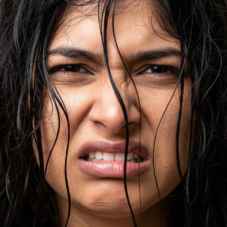 Greasy Hair Even After Washing, Causes and Proven Solutions for Oily Scalp dgtl