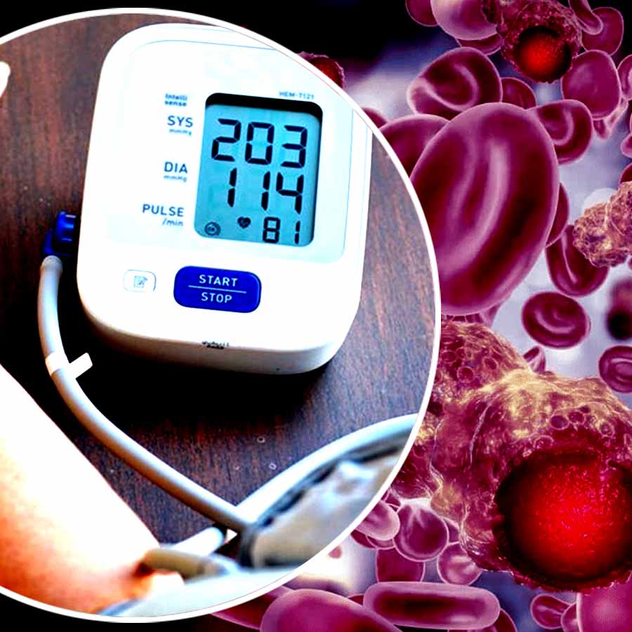 Lesser known symptoms of kidney cancer dgtl