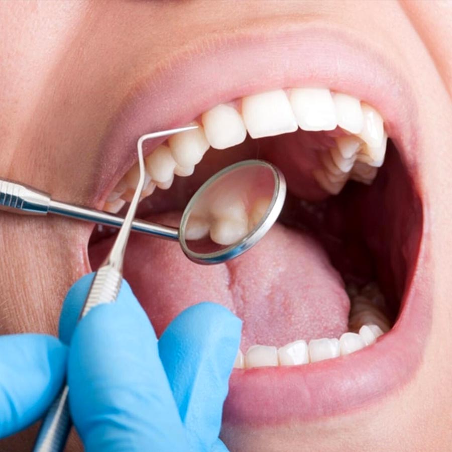 Five dental signs that point to hidden health concerns dgtl