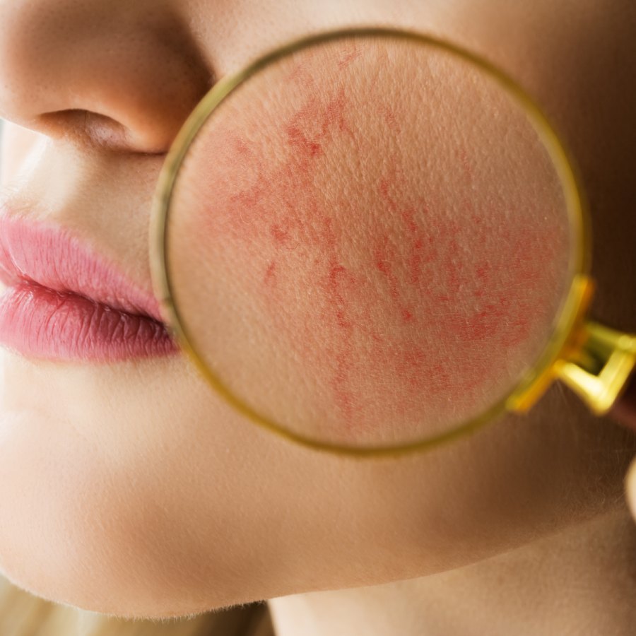 5 signs that your skin barrier is affected due to overdoing skincare dgtl