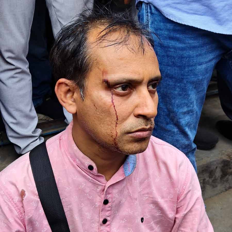 Ranaghat Teacher Beaten