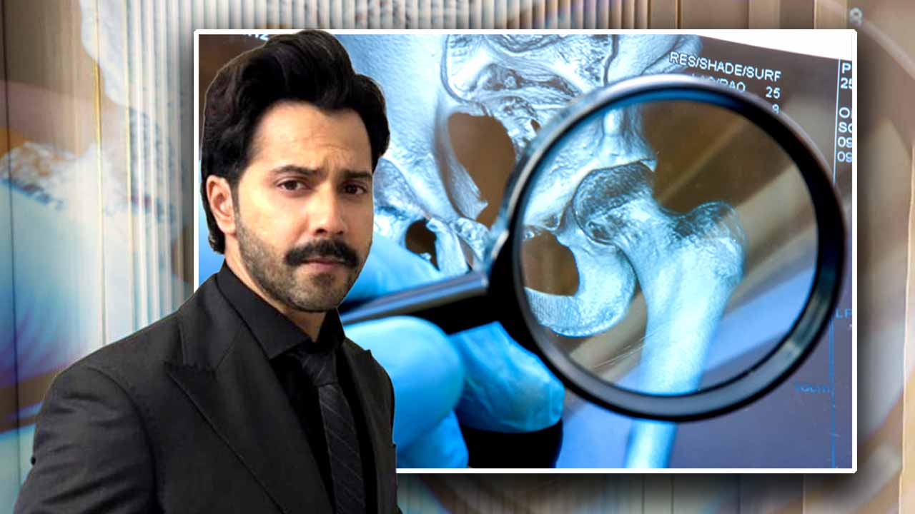 ডিডিএইচ কাদের হয়?