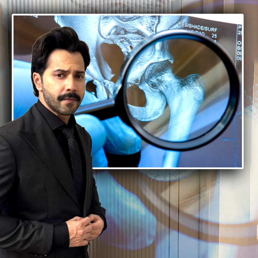 ডিডিএইচ কাদের হয়?