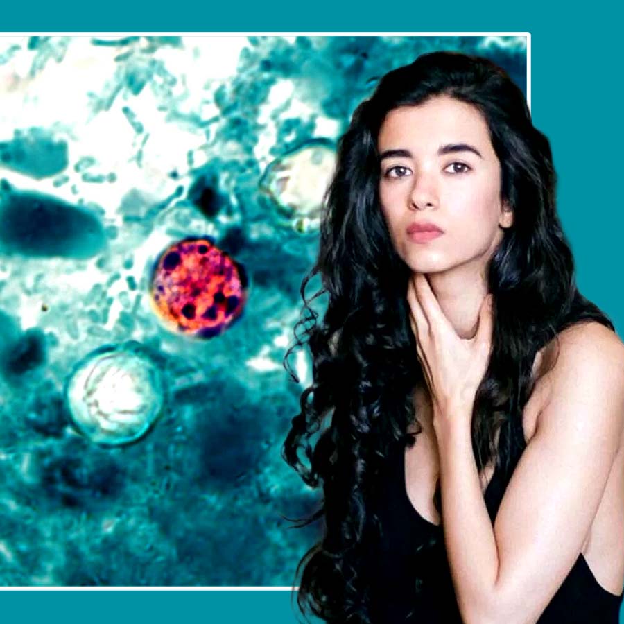 Actor Saba Azad suffering from Cyclospora Cayetanensis, a parasite that caused rapid weight loss