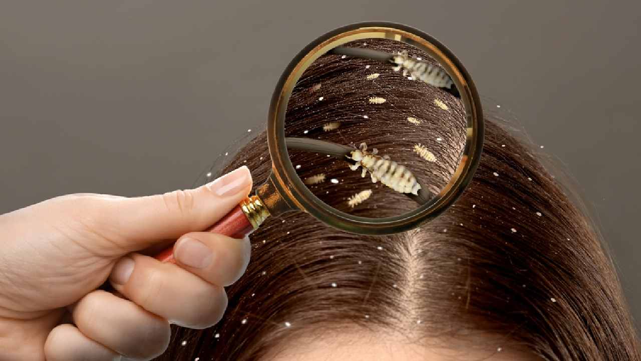 উকুন তাড়াতে যখন ফিটকিরি ভরসা।