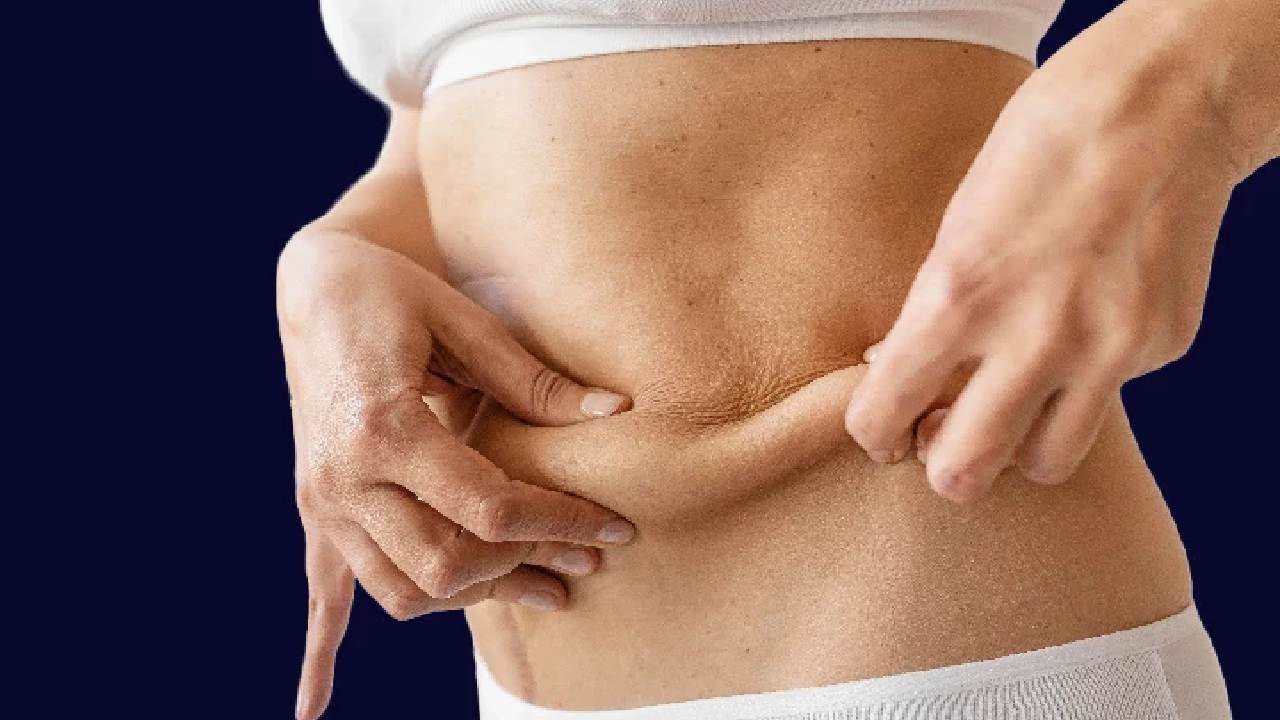 How to tighten your saggy muscle after weight loss