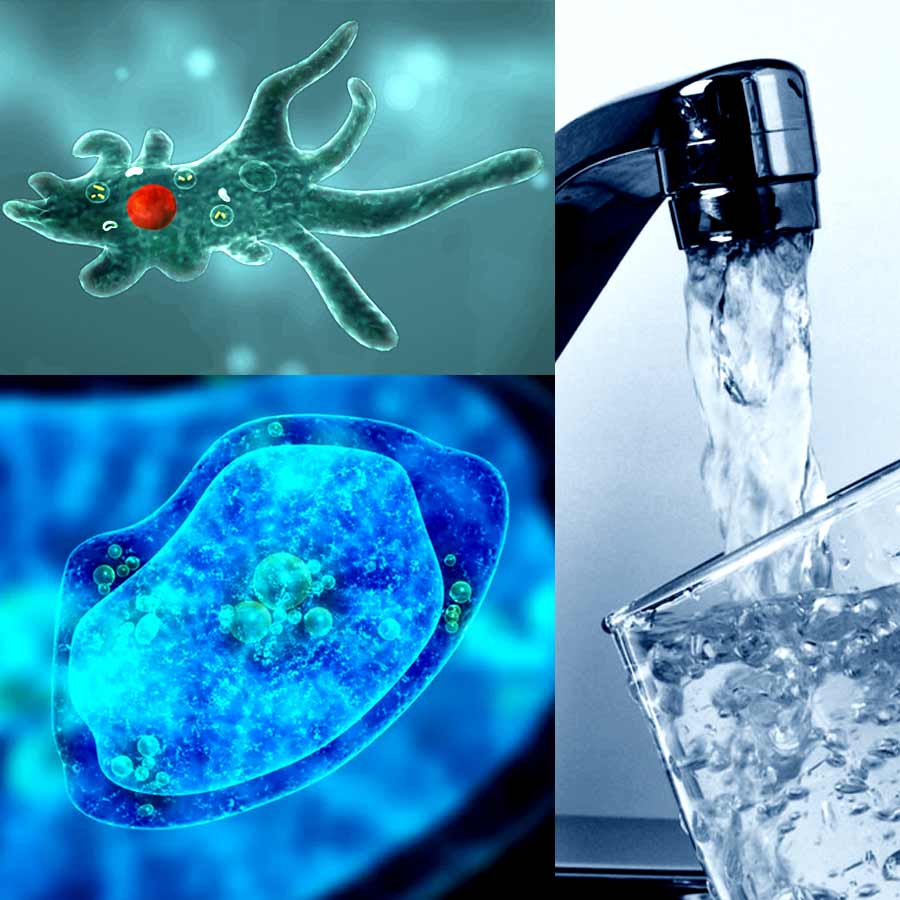 The Rise of Brain-Eating Amoeba, is your Tap Water Safe