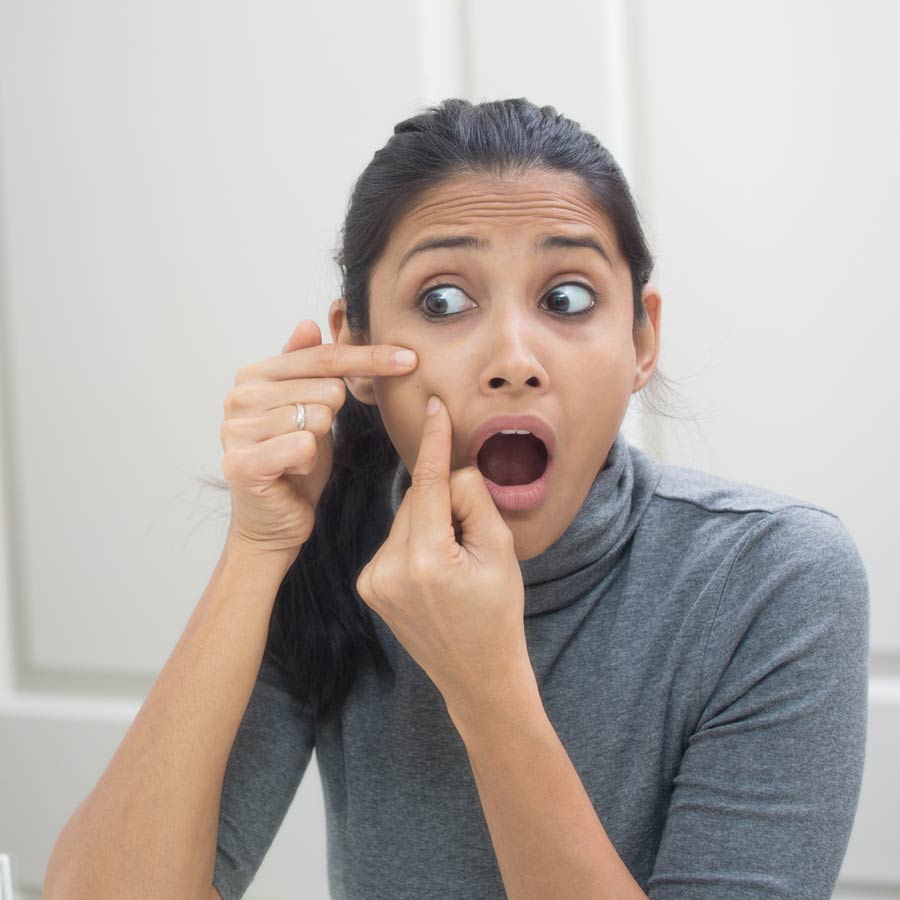ত্রিশের পরে মুখে ব্রণ! কারণ কী?