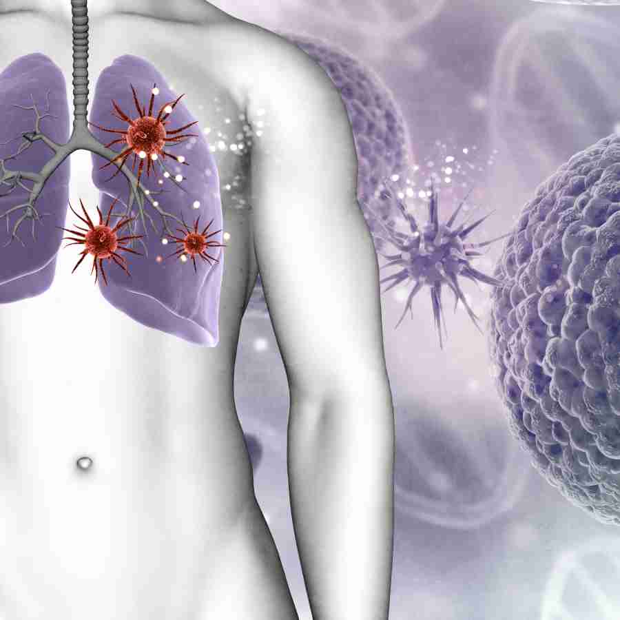 Beyond Tuberculosis, understanding Aspergillosis, the Silent Lung Attacker
