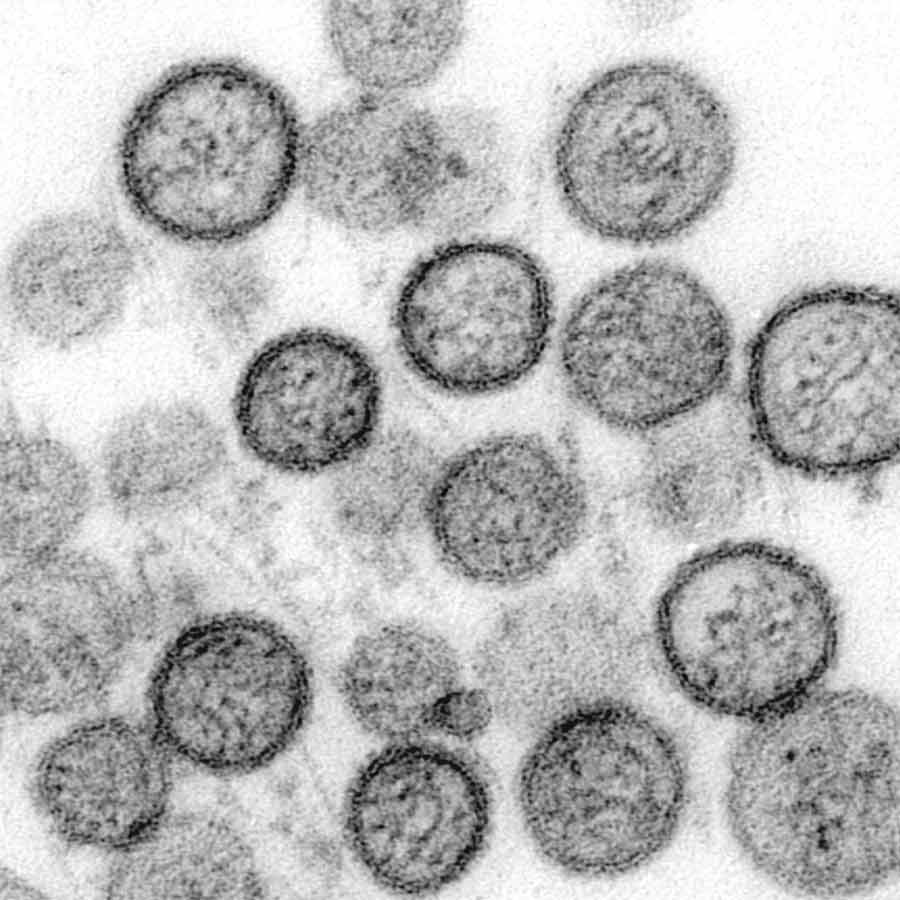 All about Hantavirus, its origin and name history