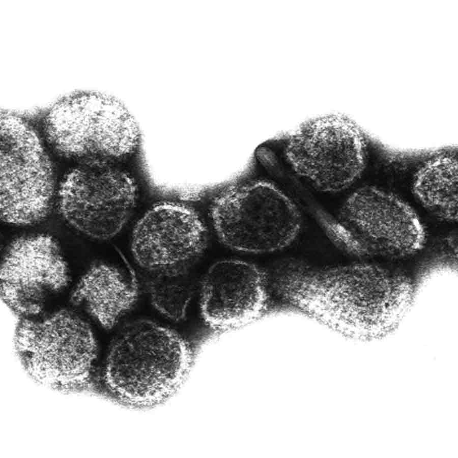 All about Hantavirus, its origin and name history