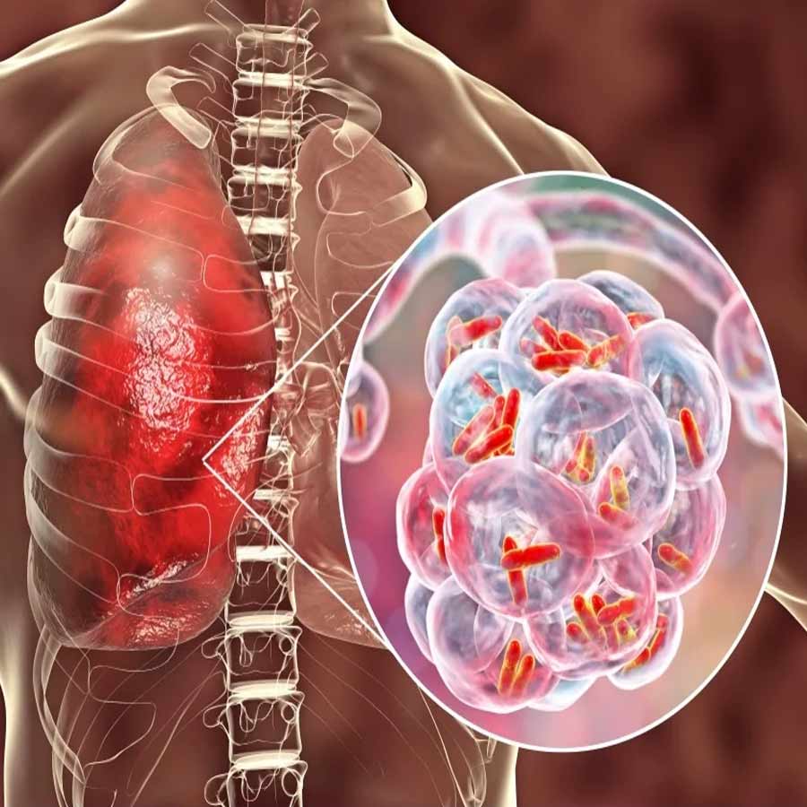 All about Hantavirus, its origin and name history