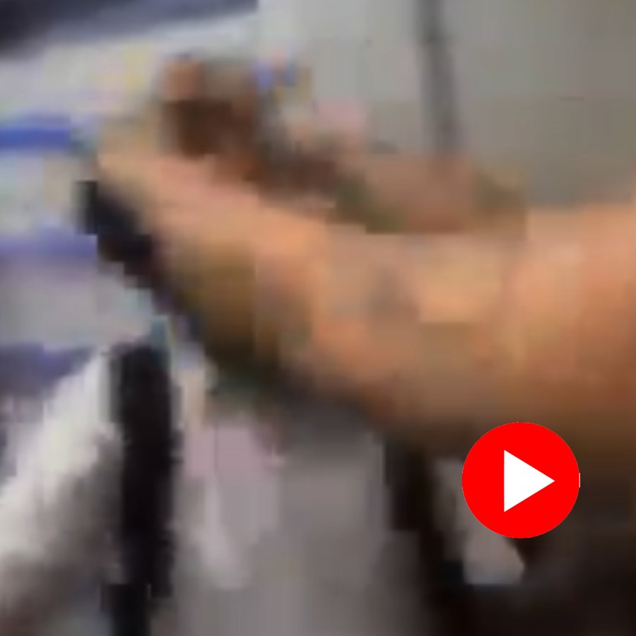 slap