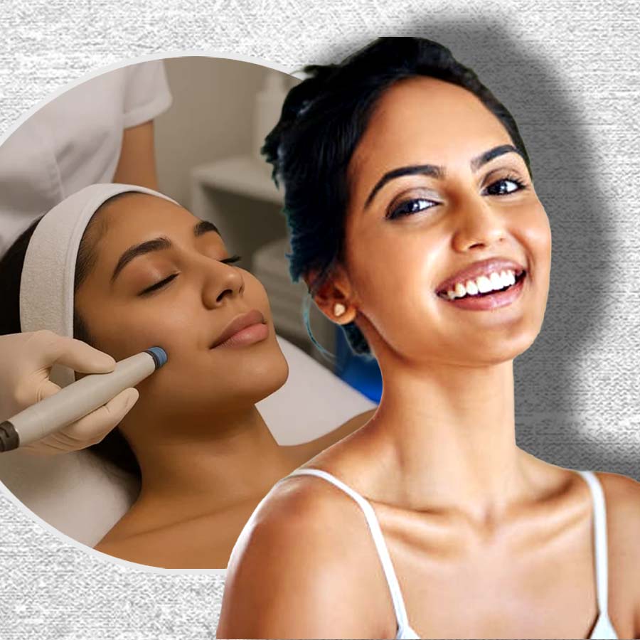 Summer Wedding Preparation, These are some essential Skincare Treatments every bride should know about