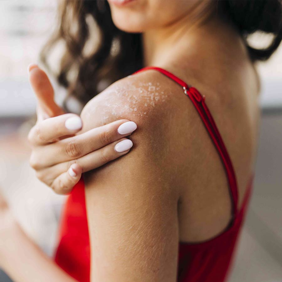 Beat the Heat and Eczema Itch, these are some Face and Body Packs for Instant Relief