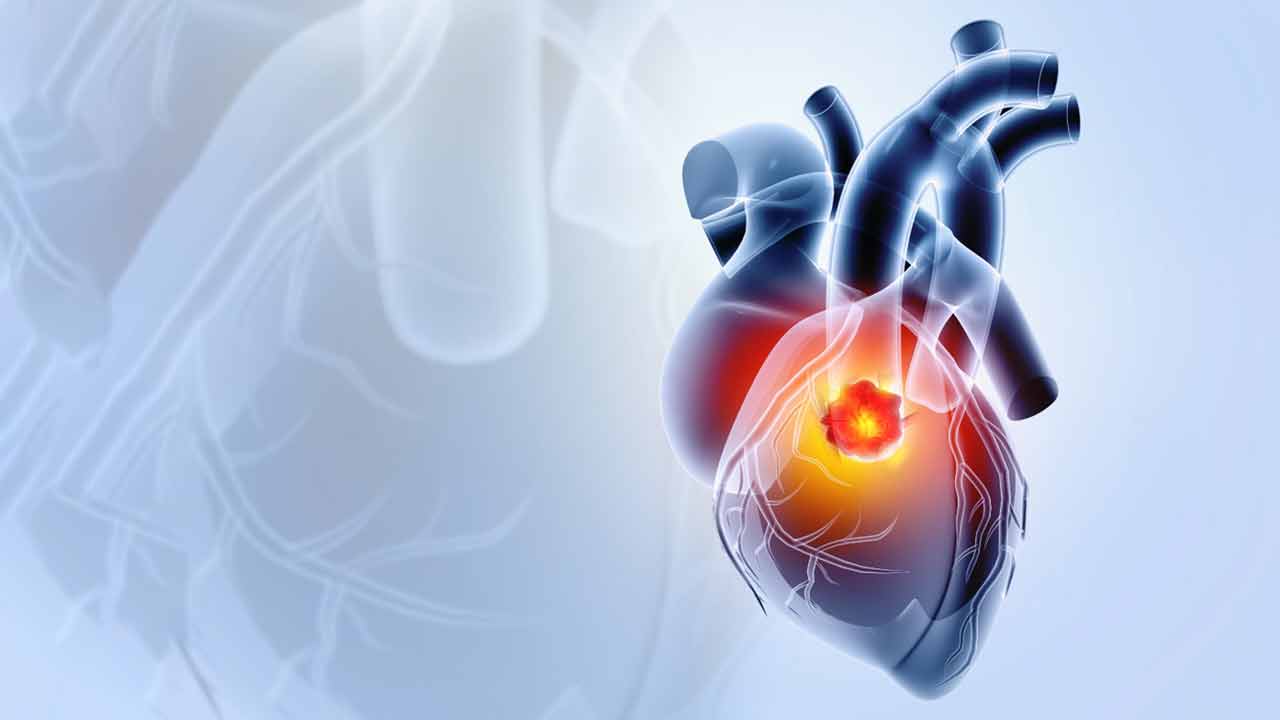 What is heart cancer, the Rare Disease Mimicking Heart Disease Signs