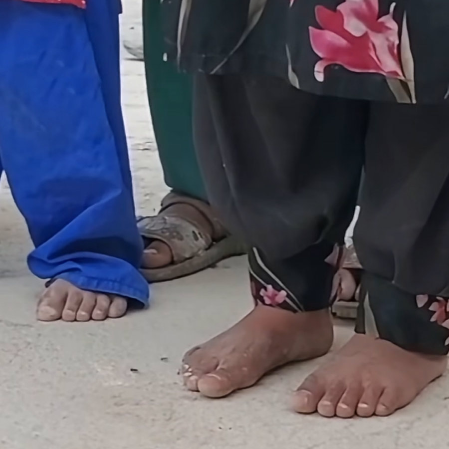 Afghan man father of 58 children struggles to feed family amid extreme poverty but still can’t stop having children