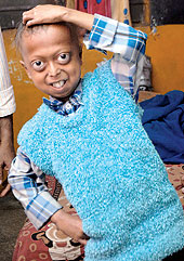 Auro the hero makes a move to meet Ali - Progeria boy in Calcutta ...