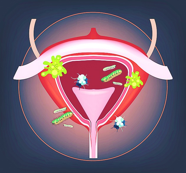 Pelvic pain - Telegraph India