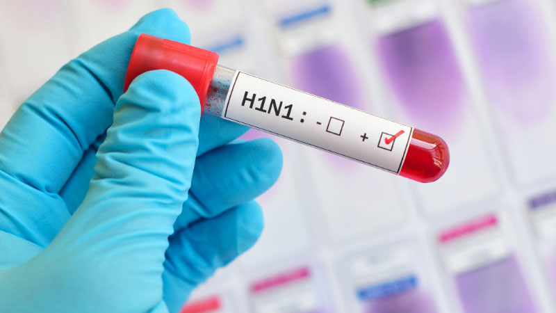 Swine flu tests will be facilitated by VTM kits that have been made available at state-run RIMS in Ranchi, MGM Medical College and Hospital in Jamshedpur and Patliputra Medical College and Hospital in Dhanbad