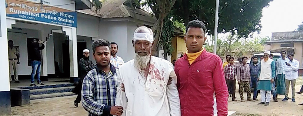 An injured NPP supporter at Gerua in Assam’s Nagaon district on Thursday
