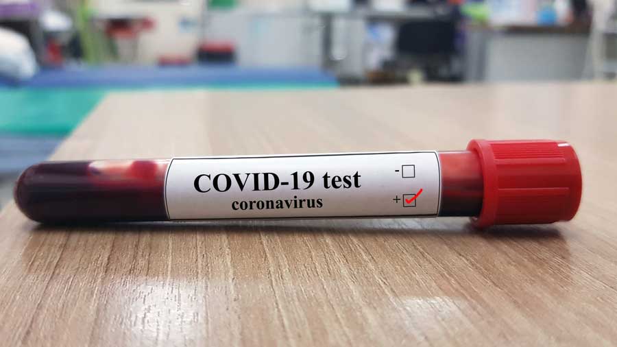 India has recorded declines in daily new coronavirus disease cases and in deaths among Covid-19 patients for three consecutive days