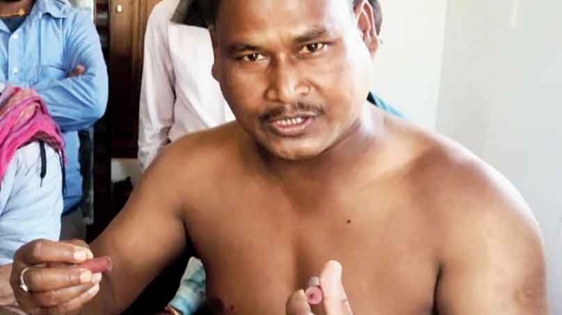 BJP: 2 more injured by pellets - Jogesh , an ex-serviceman, claimed that he was hit by two rubber bullets in the abdomen