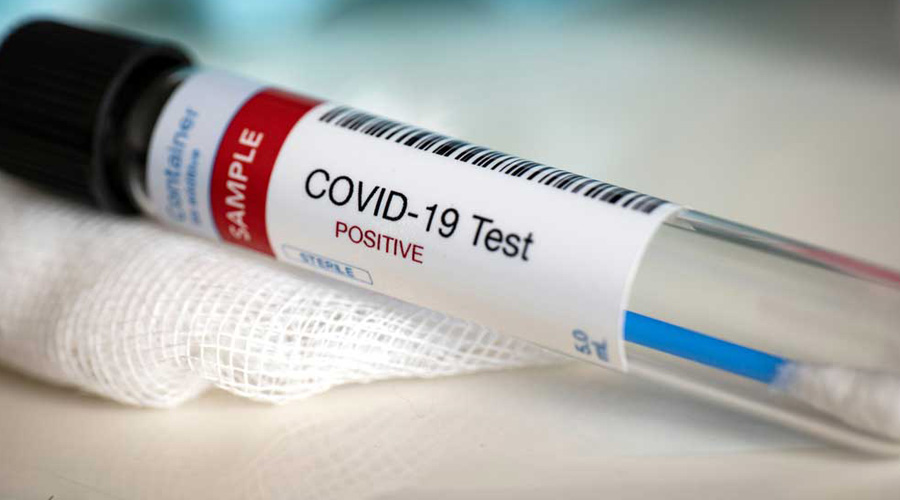 Active Covid patients down to 7,083 in Bengal - The state on Sunday logged 621 recoveries, 565 infections and 12 deaths Active Covid patients down to 7,083 in Bengal - The state on Sunday logged 621 recoveries, 565 infections and 12 deaths