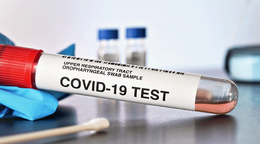 Doctor flees home on testing positive for Covid  -The medical practitioner was found near Suri district hospital after a search of around 12 hours