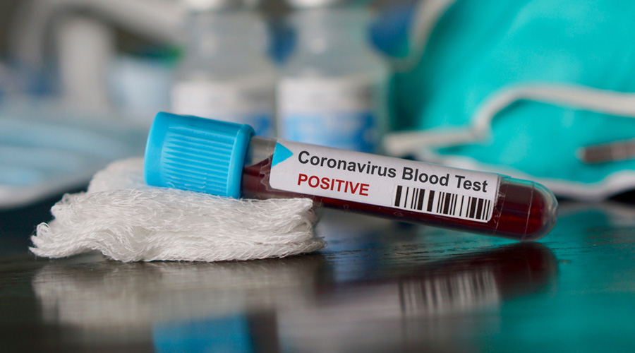 On Saturday, the state reported 44,389 tests, taking the total past 60.91 lakh, at 67,685 tests per million people. The positive confirmation rate is 8.2 per cent now.