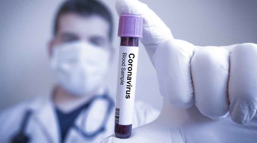 Jharkhand on Monday reported at least 16 Covid recoveries against six fresh cases of coronavirus infection, a separate bulletin from NHM stated. 