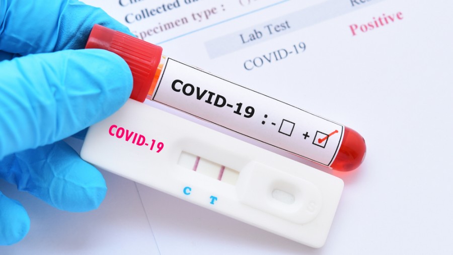 Among those under the age of 65 who had Covid-19 during the first wave, 0.60 per cent tested positive again during the second wave, the study noted.