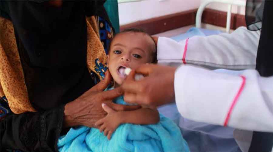 A child being treated for malnutrition in Yemen.