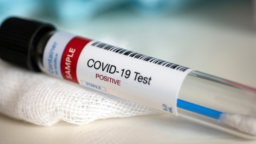 Deceptive Covid condition emerges- symptom of happy hypoxia” — a condition in which a patient feels no shortness of breath even when the oxygen saturation level is sinking steadily