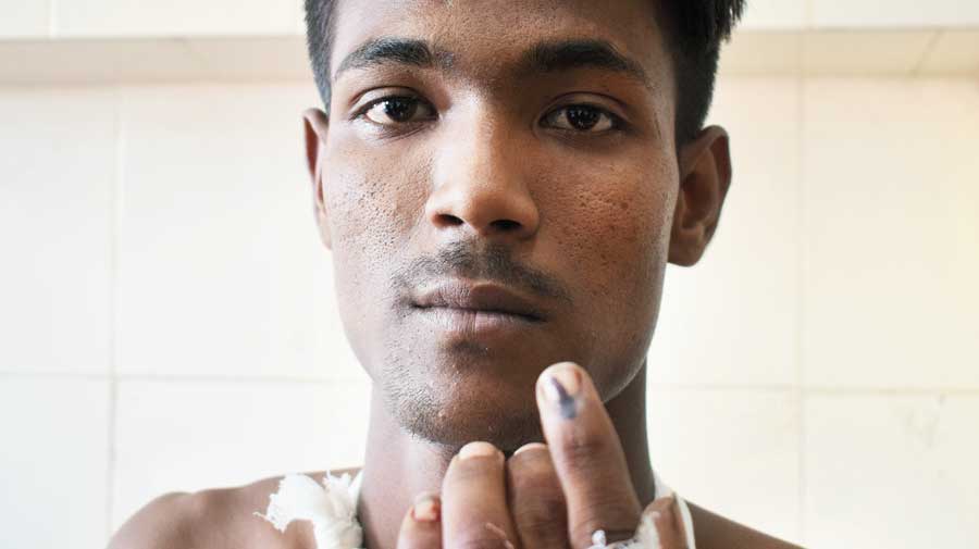    First-time Nadia voter shot at, BJP blamed- a Trinamul supporter, Santu was hit by a bullet on his left palm