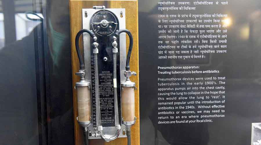 A pneumothorax apparatus used to treat tuberculosis before the BCG vaccine became popular in the 1940s