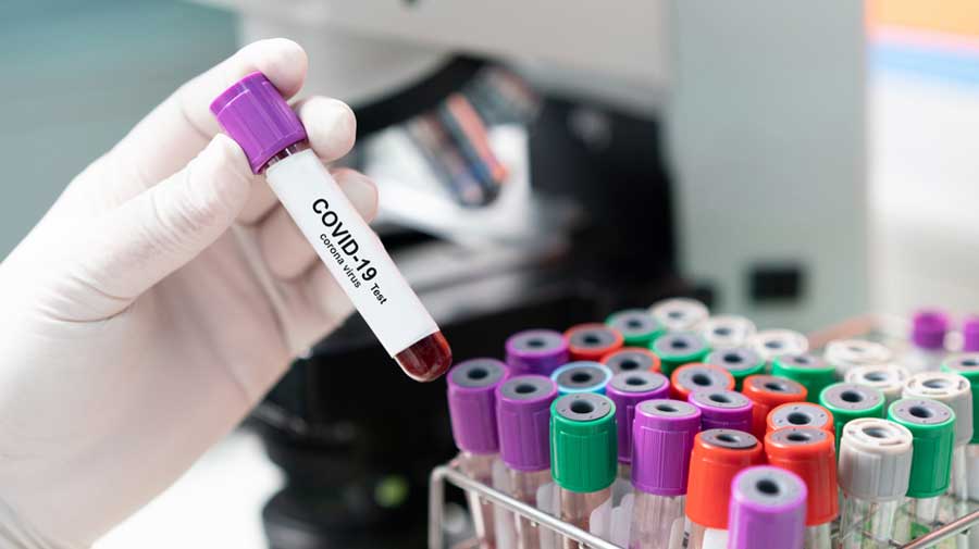 A study on global sequencing efforts released on  Thursday said India had until June 2 documented over 28.3 million lab-confirmed Covid-19 infections but deposited 15,614 sequences in an international online sequence repository available for scientific  analysis.