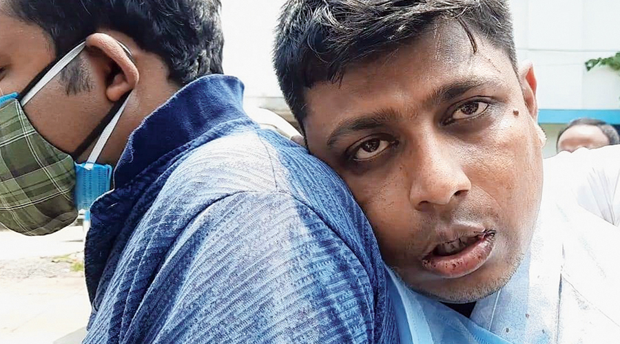    Fresh violence in Raiganj as a TMC worker hit with gun’s butt, BJP blamed