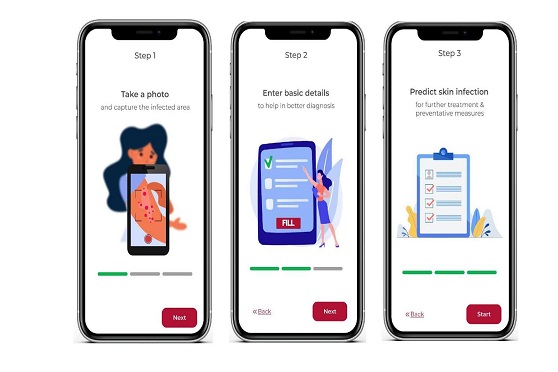 LIVEY’s AI- powered algorithm will help doctors and users identify skin conditions by sharing differential diagnosis in just three easy steps in a mobile app.