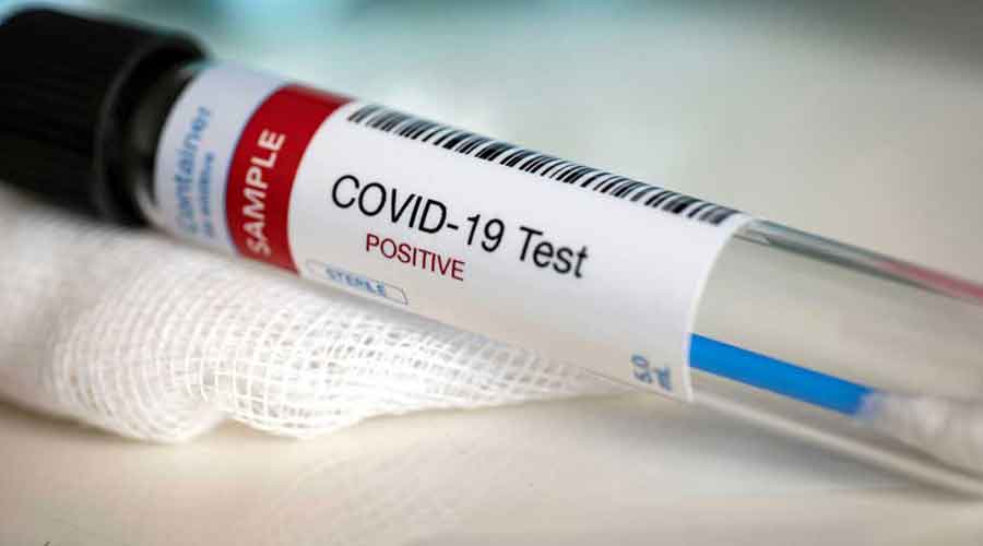 Covid-19 cases double in Kolkata in 24 hours, Bengal’s positivity rate now 5.47 per cent