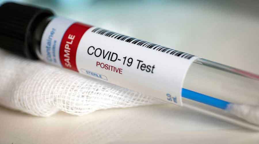 us-makes-negative-covid-19-test-report-mandatory-for-all-incoming-passengers