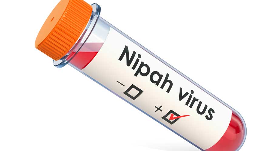 The infection is rare but deadly with a high risk of mortality. The Nipah virus resides in some species of fruit bats.